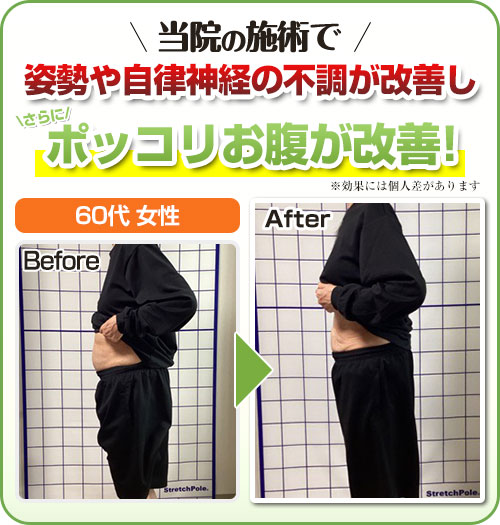 ビフォーアフター