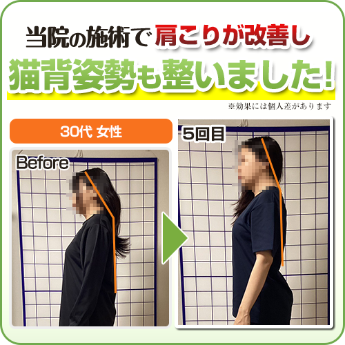 ビフォーアフター