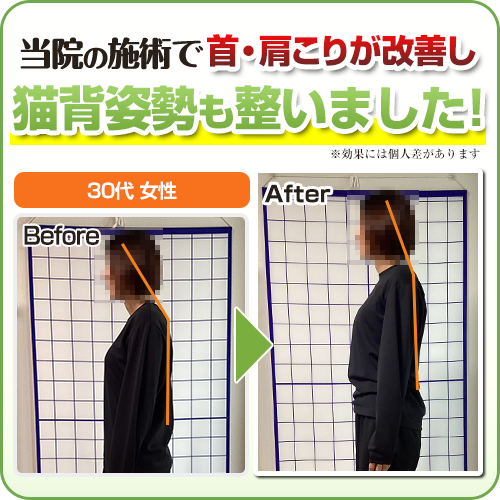 ビフォーアフター