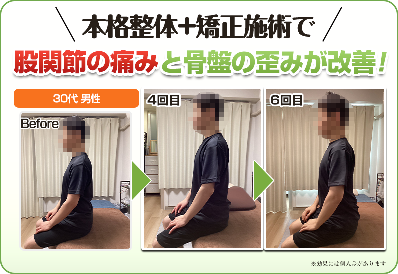 ビフォーアフター