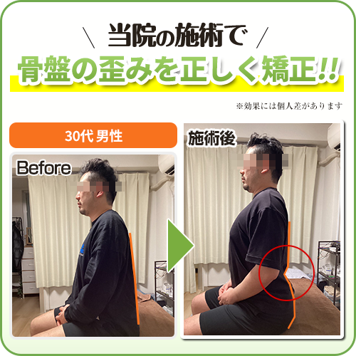 ビフォーアフター