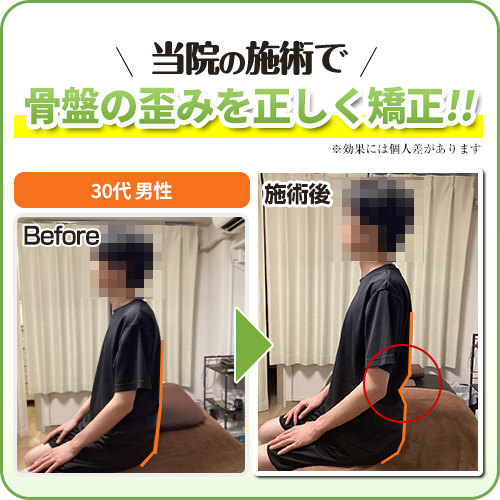 ビフォーアフター