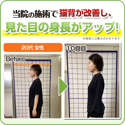 ビフォーアフター