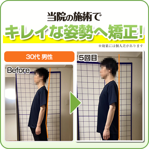 ビフォーアフター