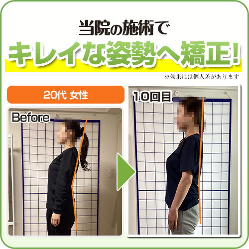 ビフォーアフター