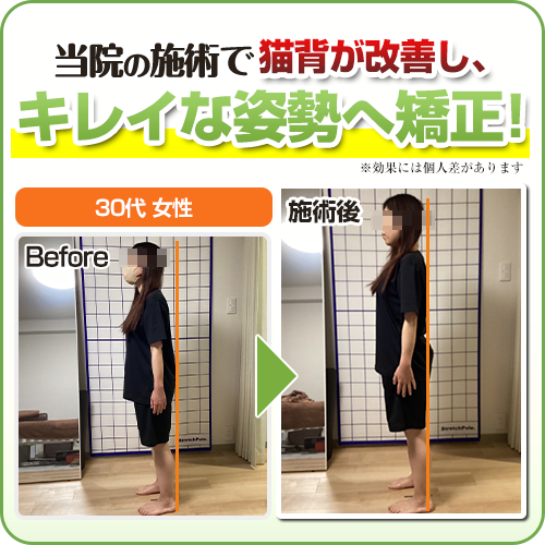 ビフォーアフター