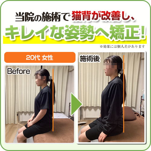 ビフォーアフター