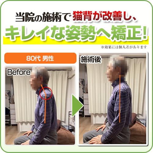 ビフォーアフター