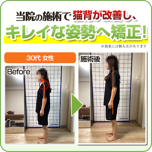 ビフォーアフター