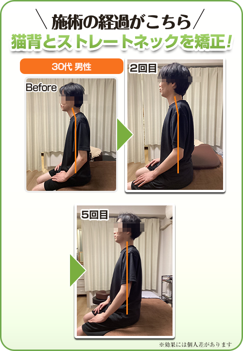 ビフォーアフター