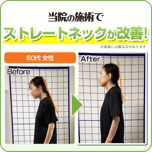 ビフォーアフター