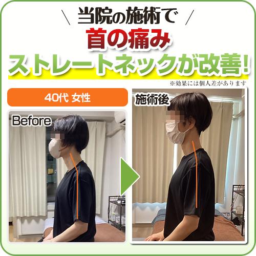 ビフォーアフター