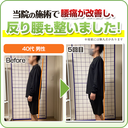 ビフォーアフター