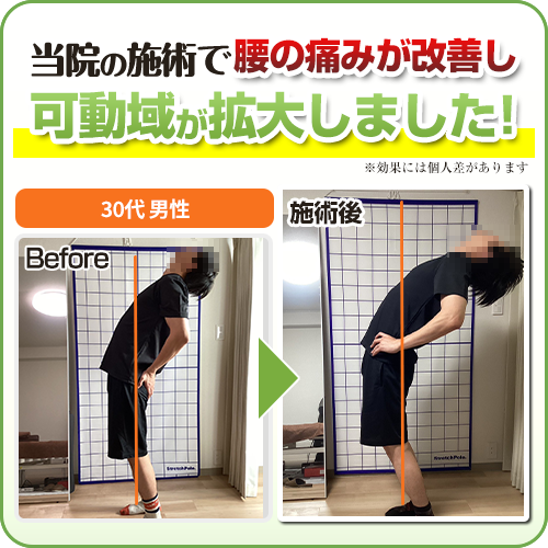ビフォーアフター