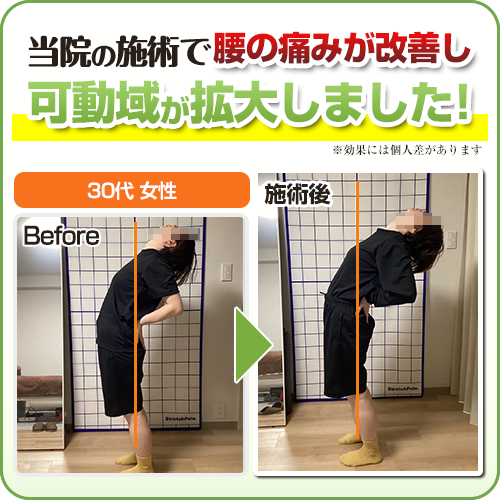ビフォーアフター