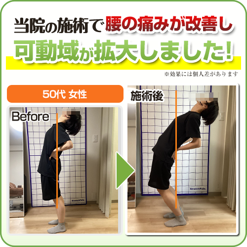 ビフォーアフター