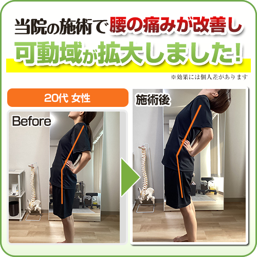 ビフォーアフター