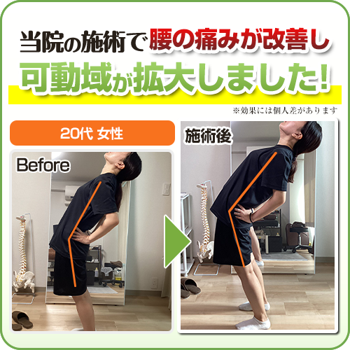 ビフォーアフター