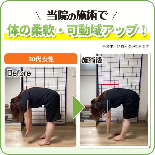 ビフォーアフター