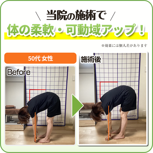ビフォーアフター