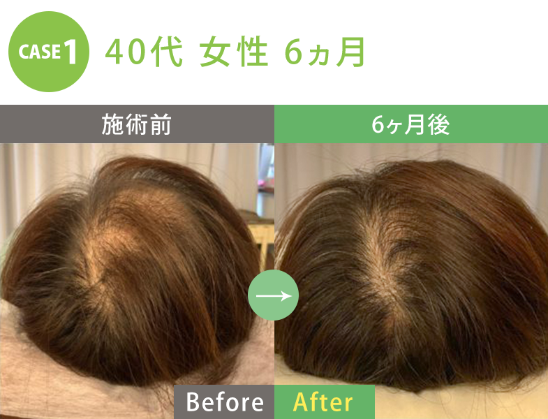 ビフォーアフター