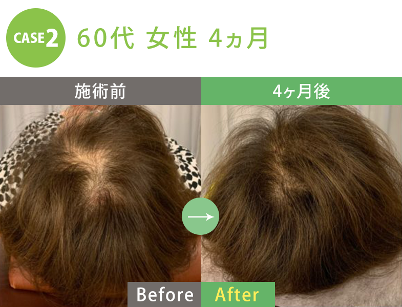 ビフォーアフター