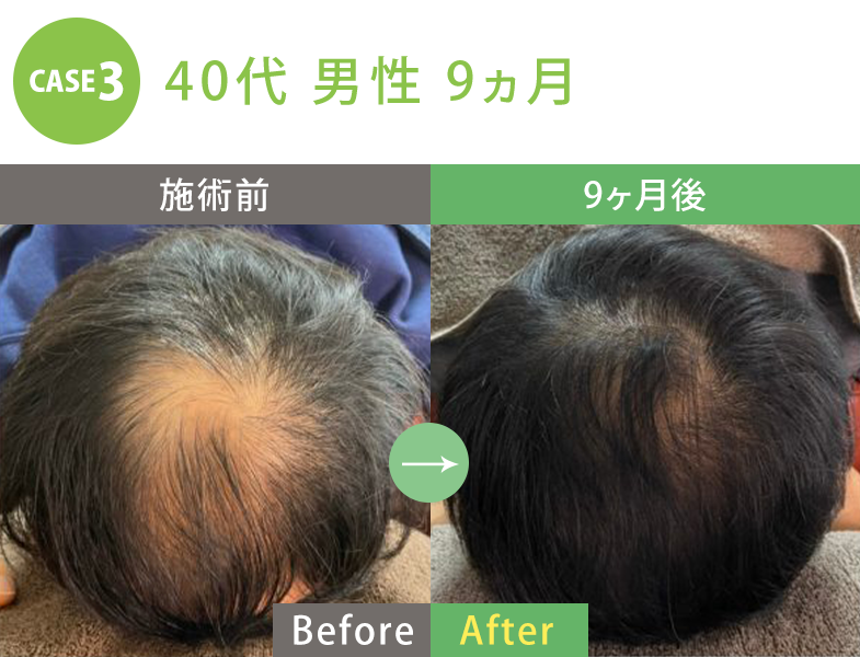 ビフォーアフター