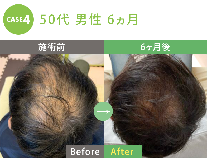 ビフォーアフター